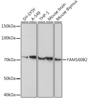 FAM160B2 Rabbit pAb