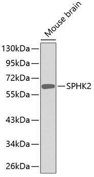 SPHK2 Rabbit pAb