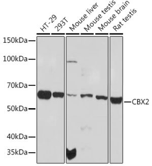 CBX2 Rabbit mAb
