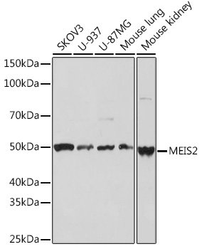 MEIS2 Rabbit mAb