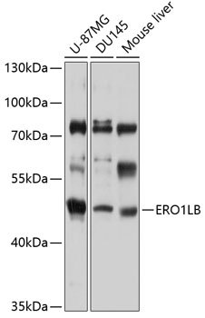 ERO1LB Rabbit pAb