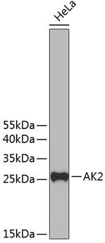 AK2 Rabbit pAb