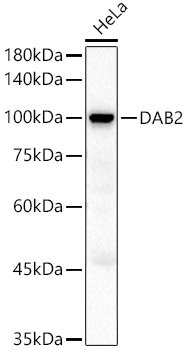 DAB2 Rabbit pAb