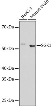 SGK1 Rabbit mAb