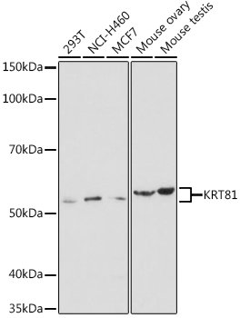 KRT81 Rabbit pAb