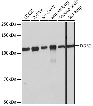 DDR2 Rabbit mAb