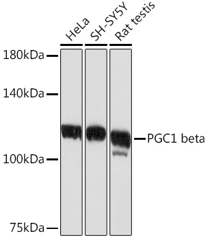 PGC1 beta Rabbit mAb
