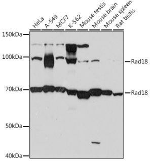 Rad18 Rabbit mAb