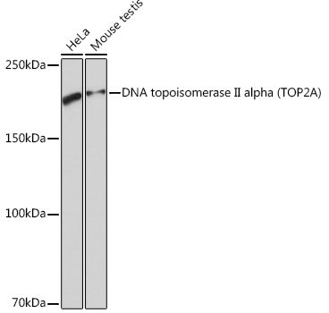 DNA topoisomerase II alpha (TOP2A) Rabbit mAb