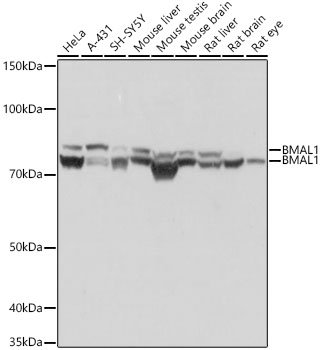 BMAL1 Rabbit mAb