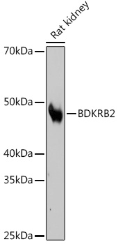 BDKRB2 Rabbit mAb