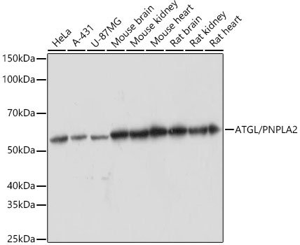 ATGL/PNPLA2 Rabbit mAb