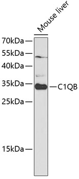 C1QB Rabbit pAb