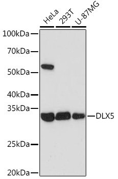 DLX5 Rabbit mAb