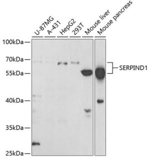 SERPIND1 Rabbit pAb