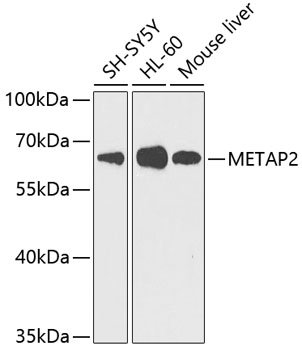 METAP2 Rabbit pAb