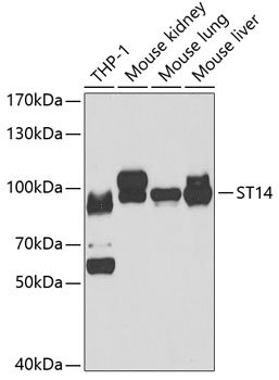 ST14 Rabbit pAb