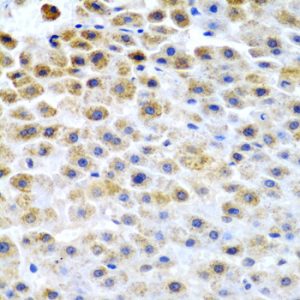 TFPI2 Rabbit pAb