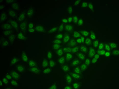 BTG1 Rabbit pAb