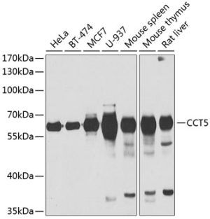 CCT5 Rabbit pAb