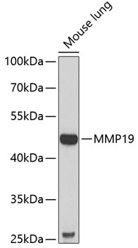 MMP19 Rabbit pAb