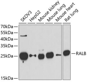 RALB Rabbit pAb