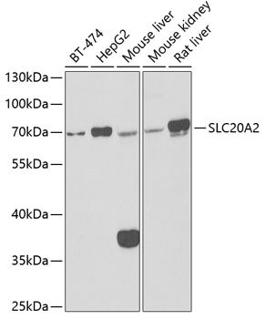SLC20A2 Rabbit pAb