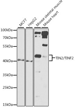 TIN2/TINF2 Rabbit pAb