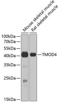 TMOD4 Rabbit pAb