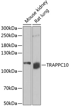 TRAPPC10 Rabbit pAb