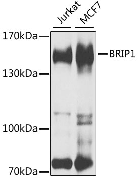 BRIP1 Rabbit pAb