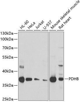 PDHB Rabbit pAb