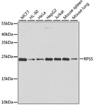 RPS5 Rabbit pAb