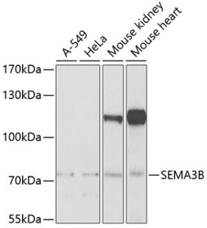 SEMA3B Rabbit pAb