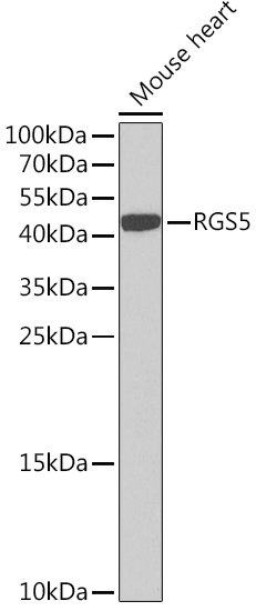 RGS5 Rabbit pAb