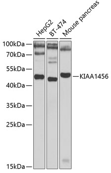 KIAA1456 Rabbit pAb