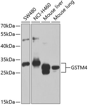 GSTM4 Rabbit pAb