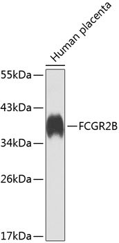 FCGR2B Rabbit pAb
