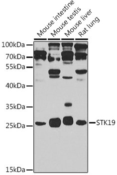 STK19 Rabbit pAb