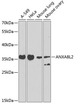 ANXA8L2 Rabbit pAb