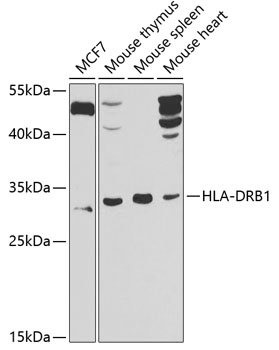 HLA-DRB1 Rabbit pAb