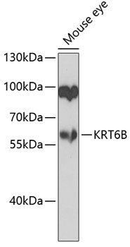 KRT6B Rabbit pAb