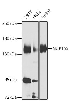 NUP155 Rabbit pAb