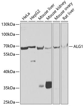 ALG1 Rabbit pAb