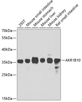 AKR1B10 Rabbit pAb