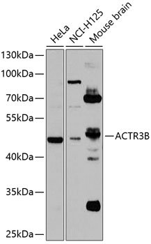 ACTR3B Rabbit pAb