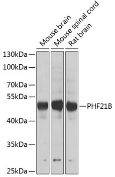 PHF21B Rabbit pAb