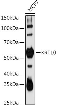 KRT10 Rabbit pAb