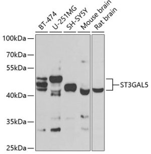 ST3GAL5 Rabbit pAb