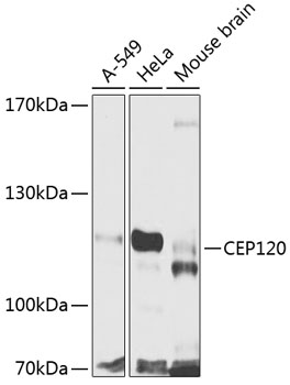 CEP120 Rabbit pAb